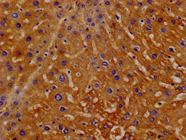 100UG HEMOPEXIN ANTIBODY 100 ug