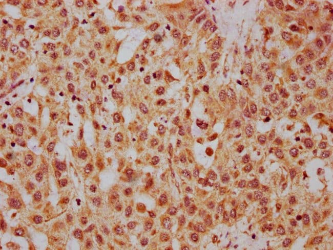 100UG HRG ANTIBODY 100 ug