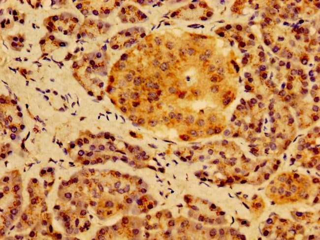 100UG HS2ST1 ANTIBODY 100 ug