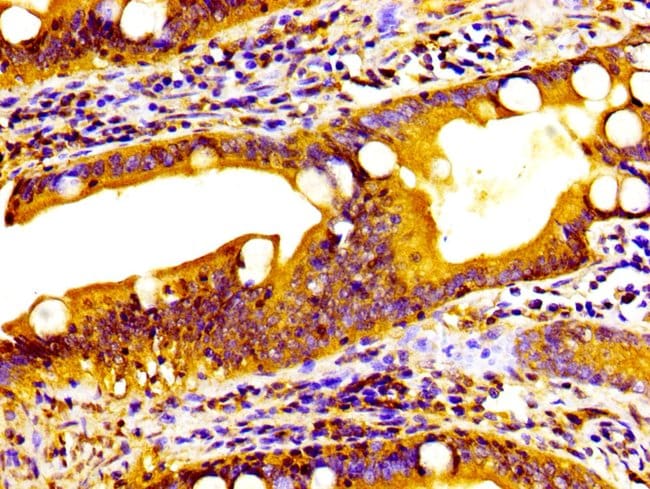 100UG HSD11B2 ANTIBODY 100 ug