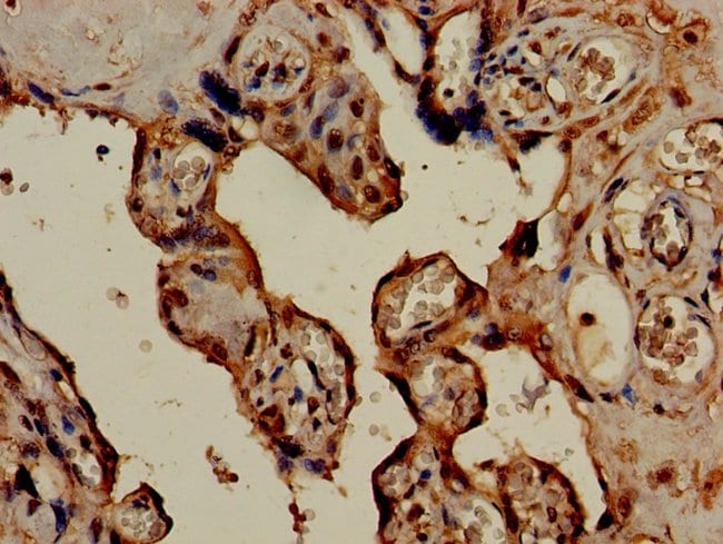 100UG HSD3B1 ANTIBODY 100 ug