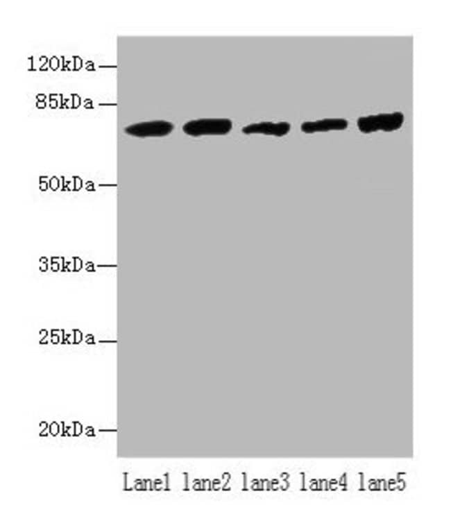 100UG HSPA1B ANTIBODY 100 ug