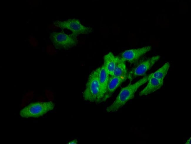 100UG HTR1E ANTIBODY 100 ug