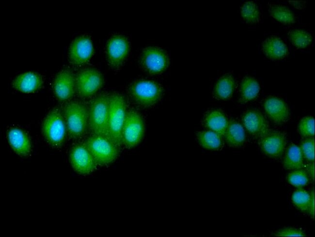 100UG HUS1 ANTIBODY 100 ug
