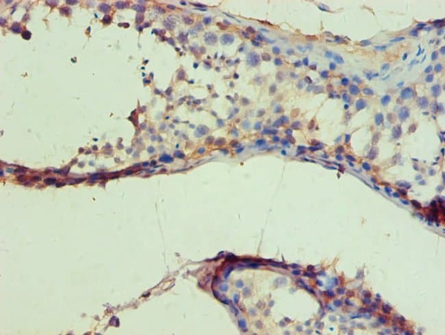 100UL IDH1 ANTIBODY 100 ul