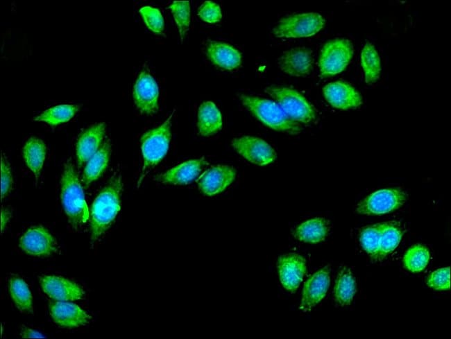 100UG IDH3A ANTIBODY 100 ug