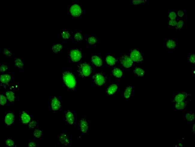 100UG IFI44 ANTIBODY 100 ug