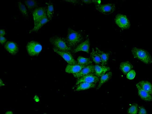 100UG IFI44L ANTIBODY 100 ug