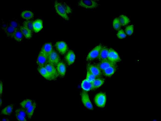 100UG IFITM2 ANTIBODY 100 ug