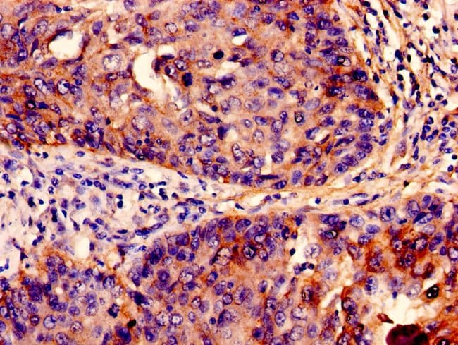 100UG IFITM3 ANTIBODY 100 ug