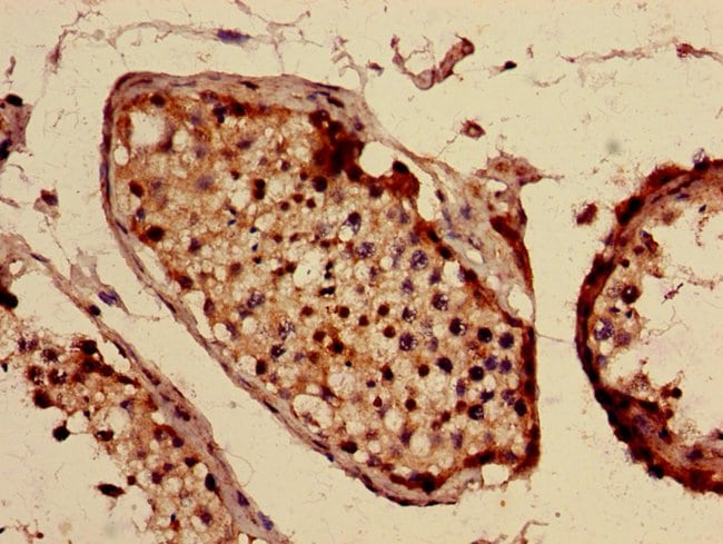 100UG INTERFERON ALPHA-10 ANTIBODY 100 u