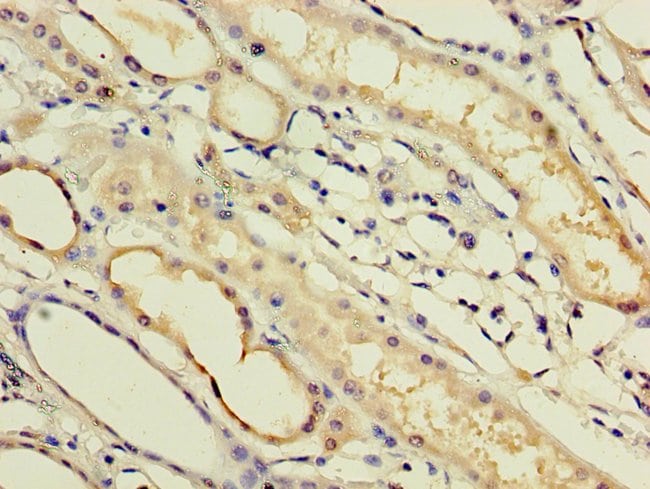100UG IFNA14 ANTIBODY 100 ug
