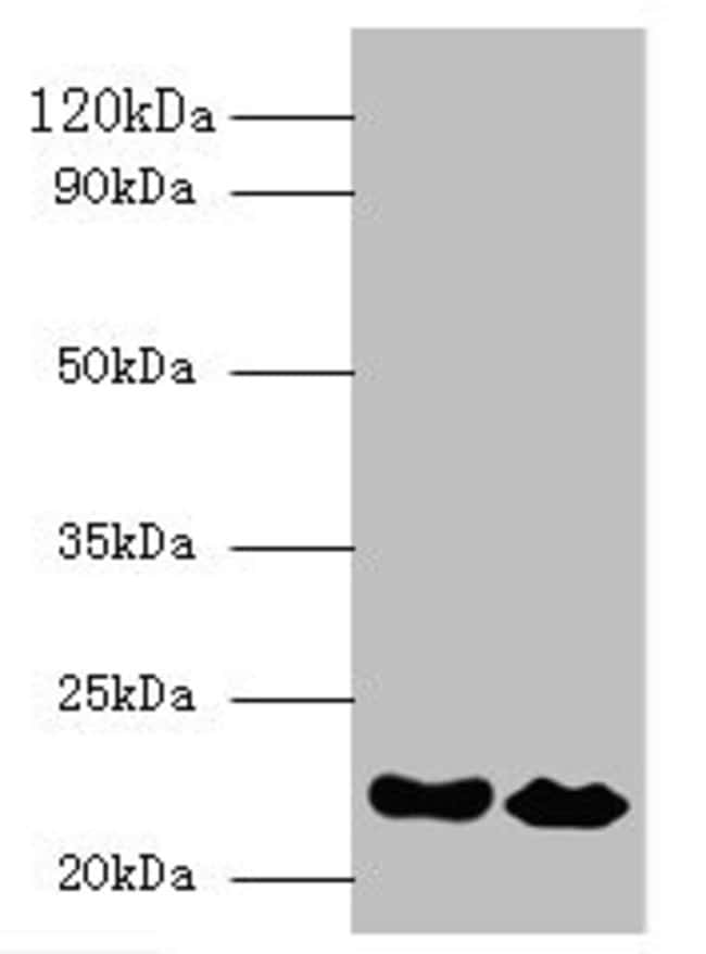 100UG INTERFERON ALPHA-21 ANTIBODY 100 u