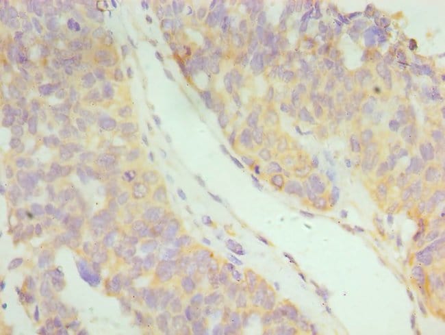 100UL IFNAR2 ANTIBODY 100 ul