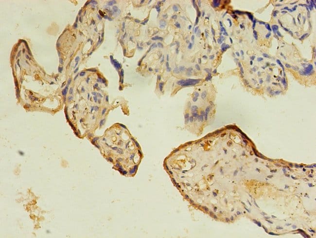 100UG IFRD2 ANTIBODY 100 ug
