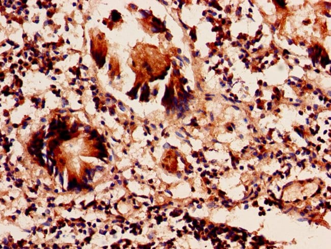 100UG SRM ANTIBODY 100 ug