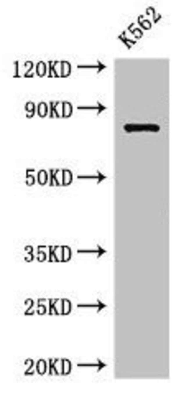 100UG IL12RB1 ANTIBODY 100 ug
