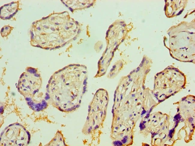 100UL IL1R1 ANTIBODY 100 ul