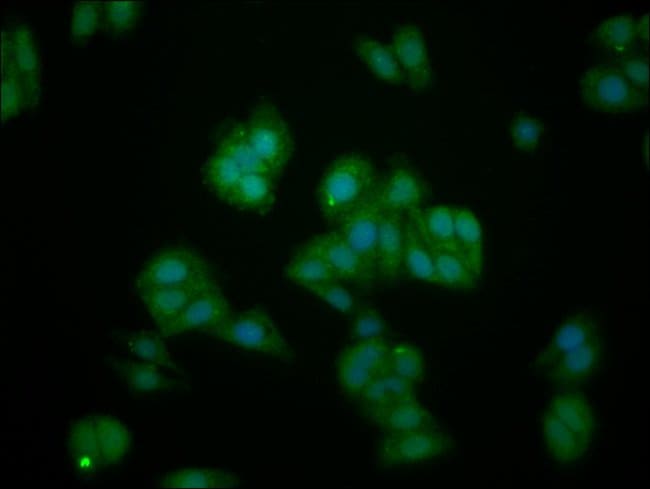 100UG IL1RAPL1 ANTIBODY 100 ug