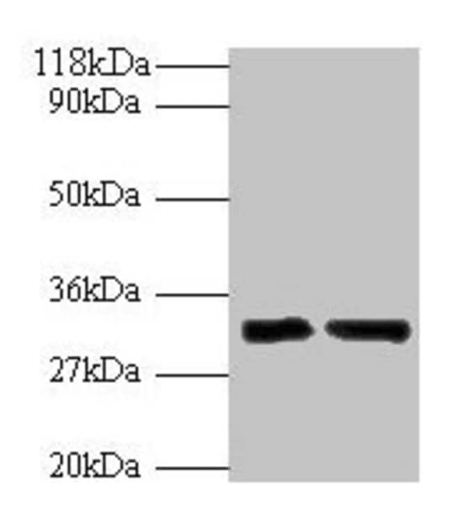 100UG IL-33 ANTIBODY 100 ug