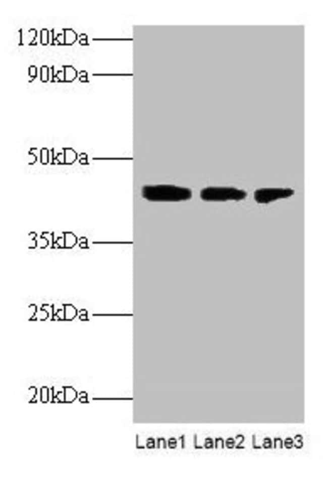 100UG ILKAP ANTIBODY 100 ug