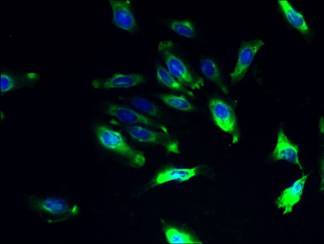 100UG ILVBL ANTIBODY 100 ug