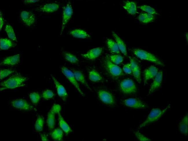 100UG IMPDH2 ANTIBODY 100 ug