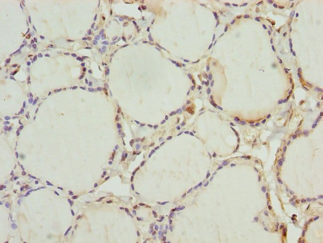 100UL INHBC ANTIBODY 100 ul