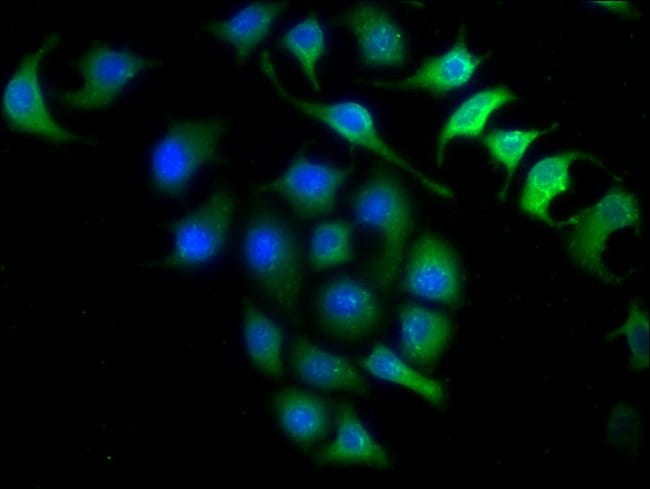 100UG INMT ANTIBODY 100 ug