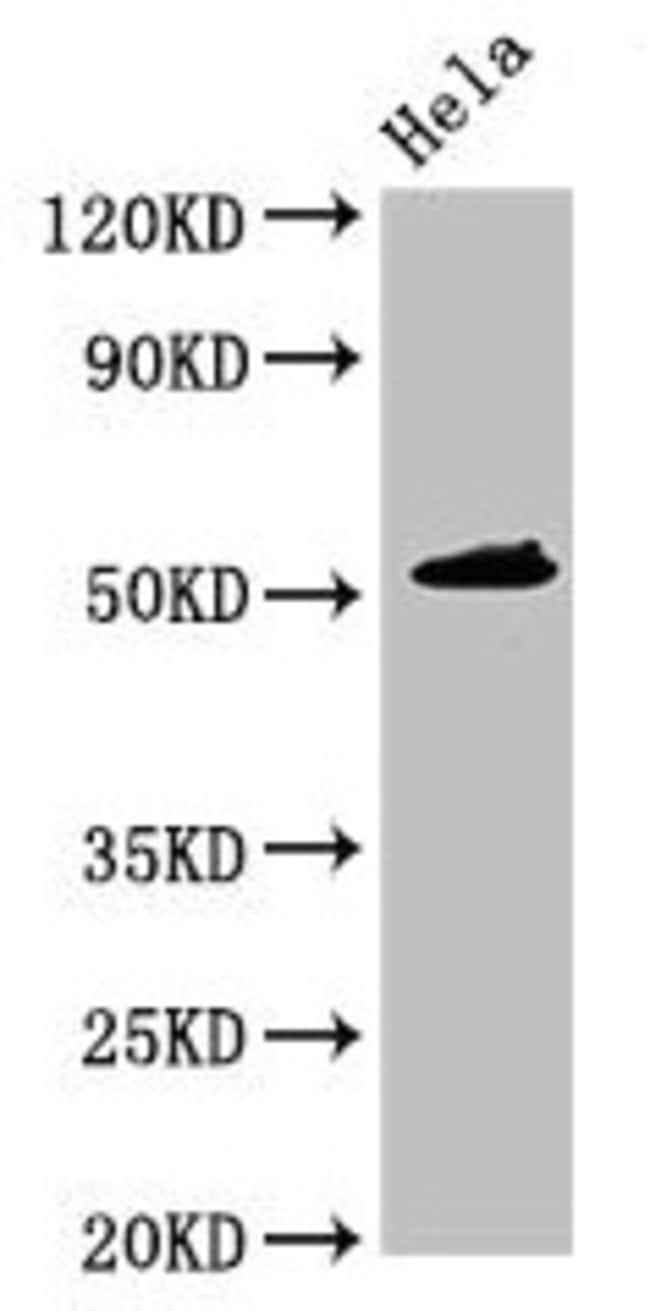 100UG IP6K1 ANTIBODY 100 ug