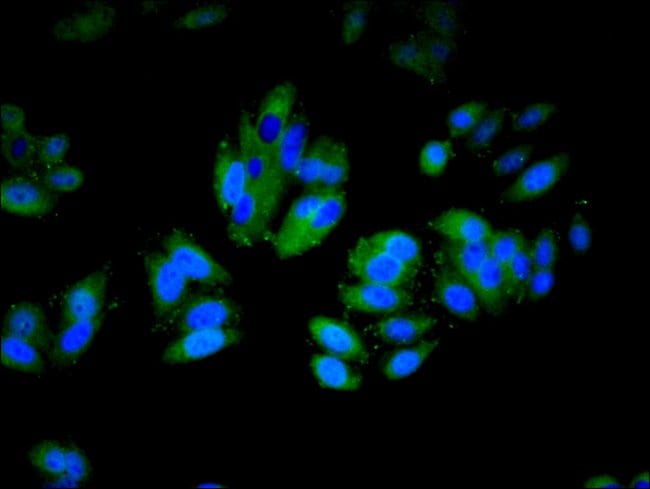 100UG CD11A ANTIBODY 100 ug