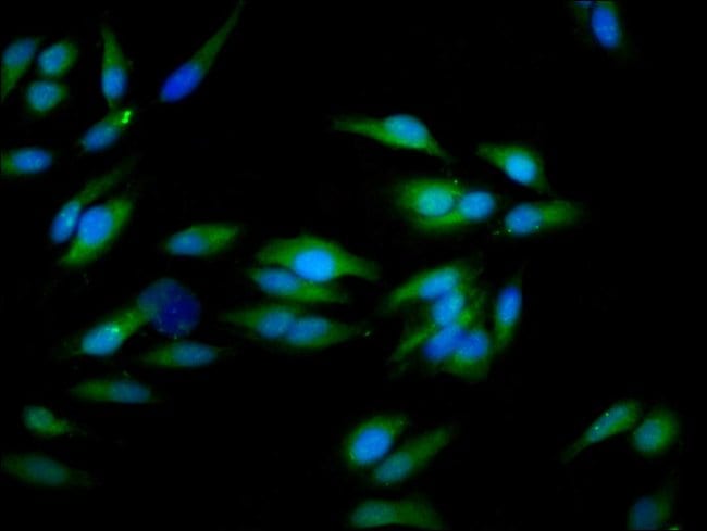 100UG CD51 ANTIBODY 100 ug
