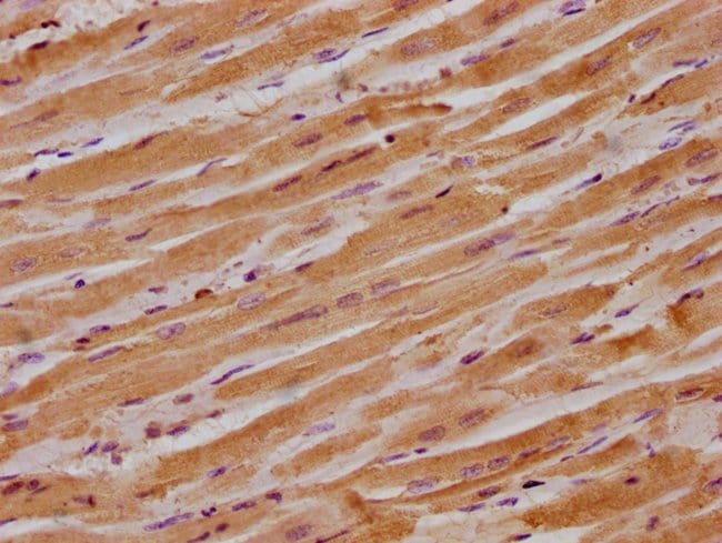 100UL ITGB1BP1 ANTIBODY 100 ul