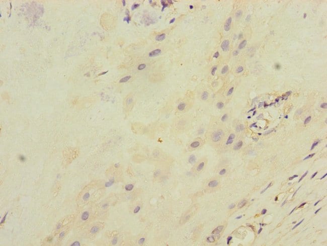 100UL ITGB8 ANTIBODY 100 ul