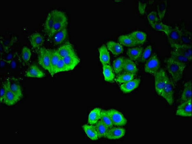 100UG ITM2A ANTIBODY 100 ug