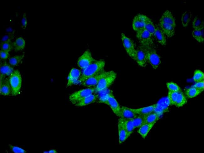 100UG IMPDH2 ANTIBODY 100 ug