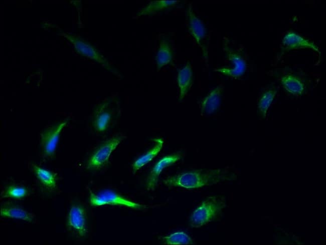 100UG KIR1.1 (KCNJ1) ANTIBODY 100 ug