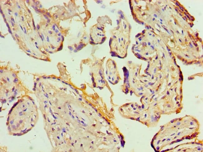 100UL KCNN4 ANTIBODY 100 ul