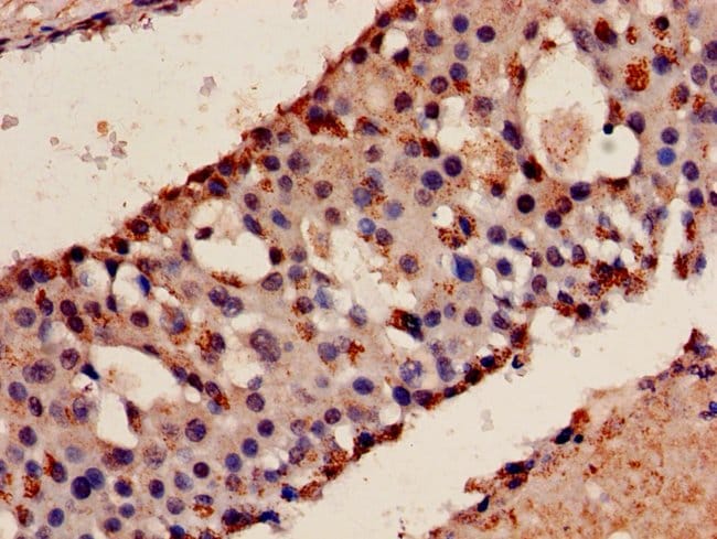 100UG KEAP1 ANTIBODY 100 ug