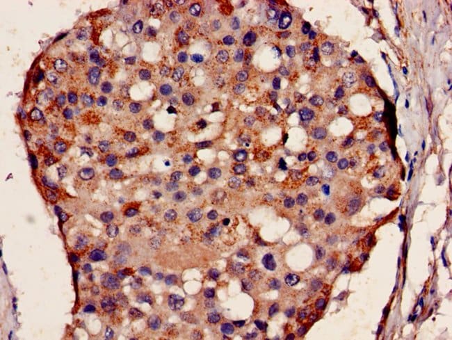100UG KELL ANTIBODY 100 ug