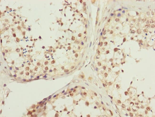 100UL KIAA0391 ANTIBODY 100 ul
