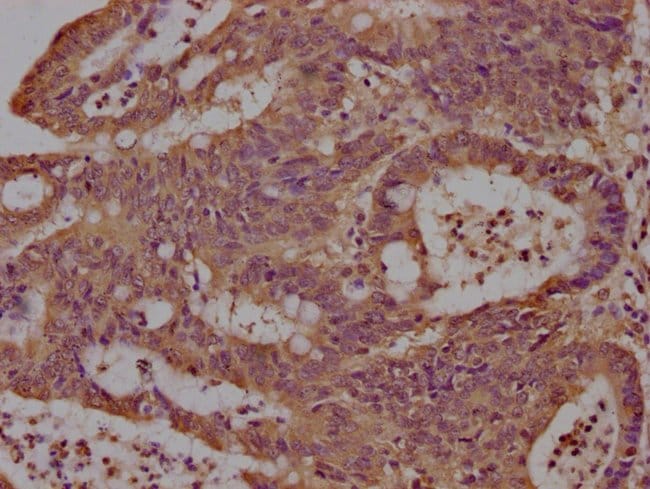 100UL LCHN ANTIBODY 100 ul