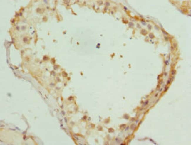 100UL KIF3A ANTIBODY 100 ul