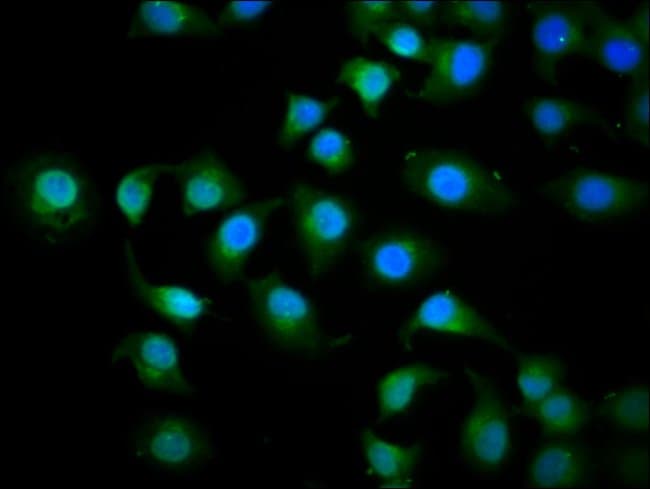 100UG KIF3C ANTIBODY 100 ug