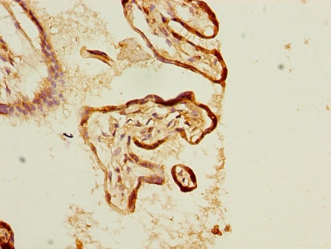 100UL KLC1 ANTIBODY 100 ul