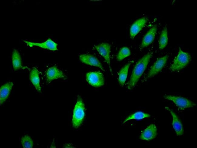 100UG KLHL2 ANTIBODY 100 ug