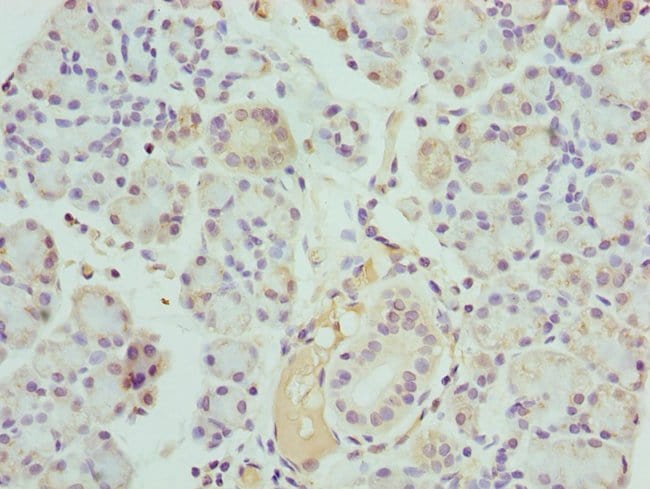 100UL KALLIKREIN 10 ANTIBODY 100 ul