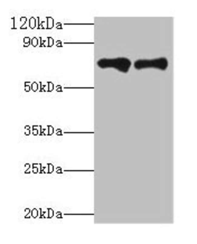 100UG PLASMA KALLIKREIN ANTIBODY 100 ug