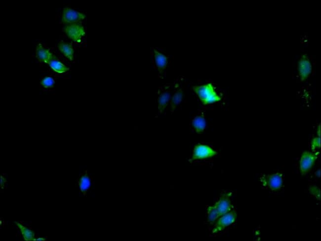 100UG KPNA2 ANTIBODY 100 ug
