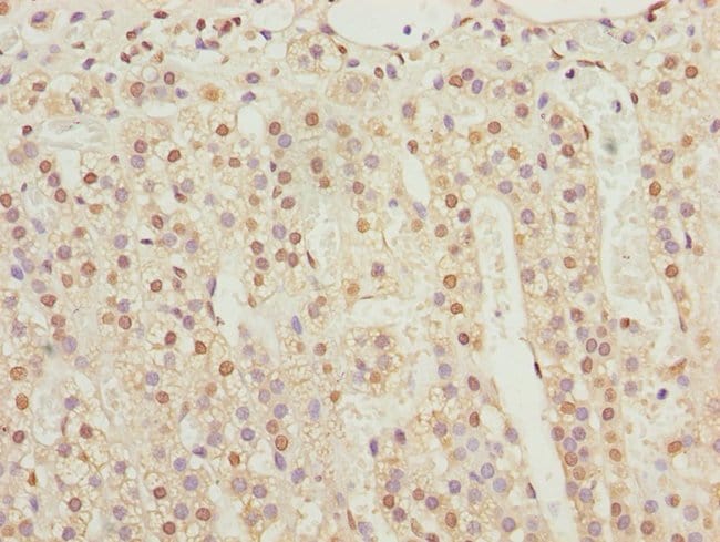 100UL KPNA6 ANTIBODY 100 ul
